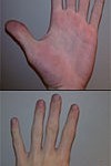 Qué significa cada dedo en quiromancia